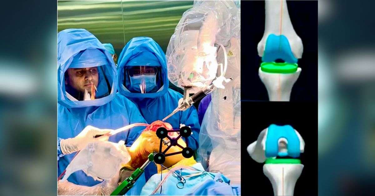 Read more about the article Robotic Knee Surgery Doctor in Mumbai